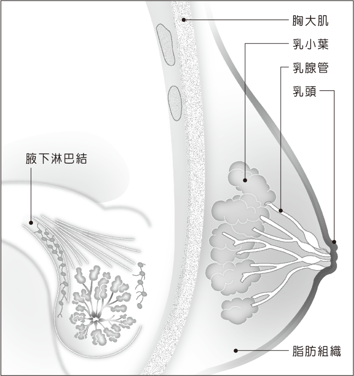 乳癌