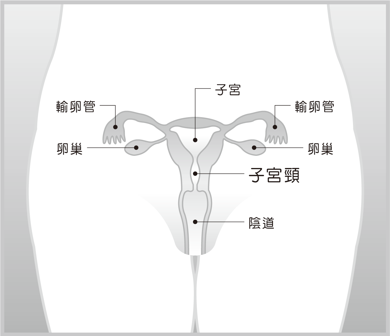 子宮頸癌