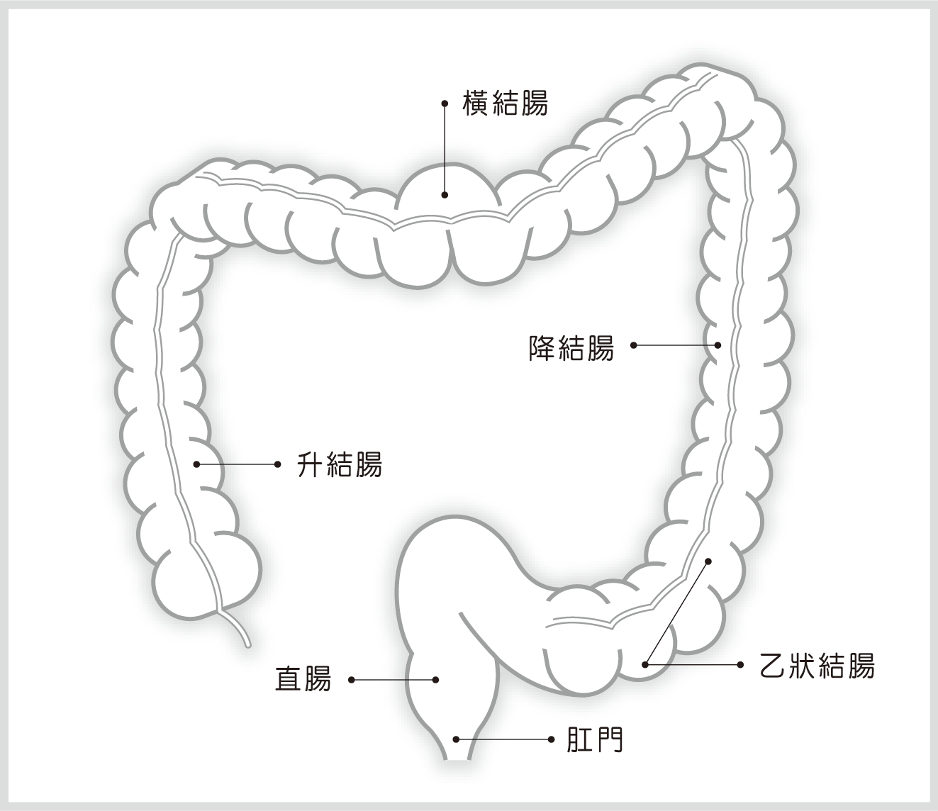 大腸直腸癌