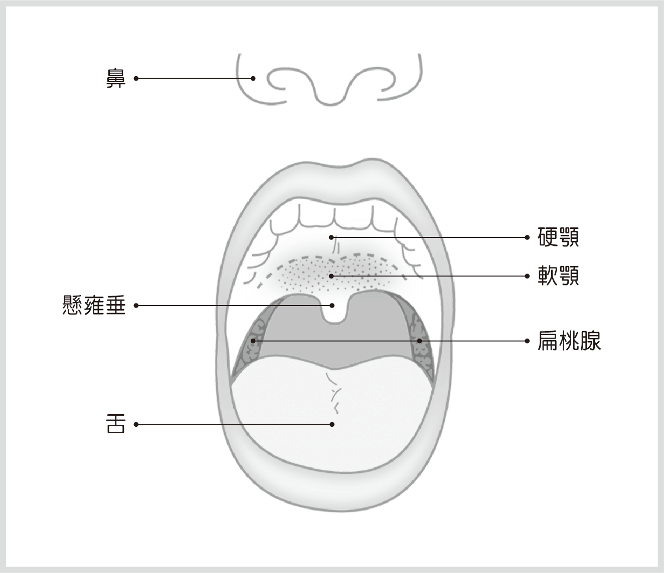 口腔癌