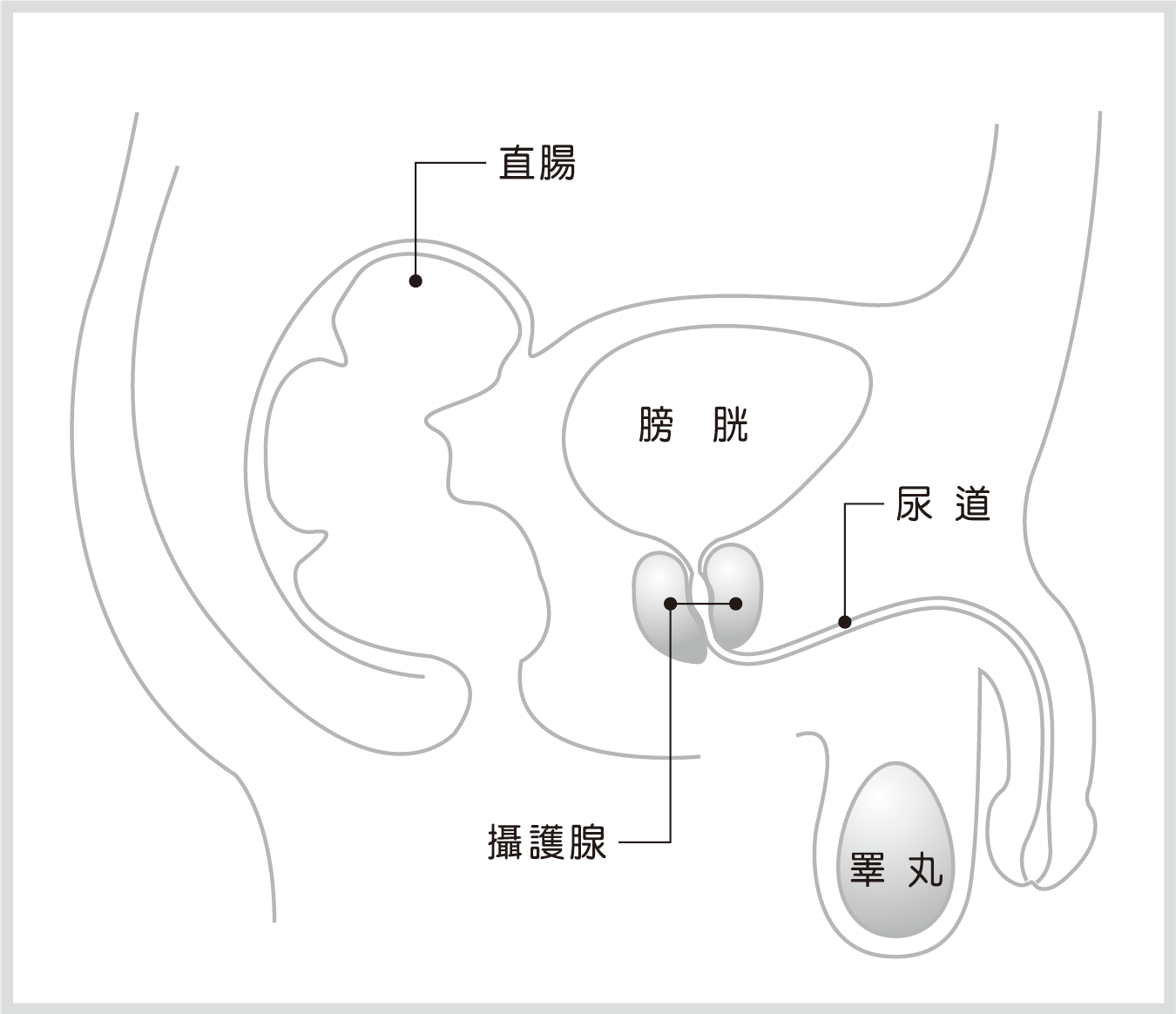 攝護腺癌