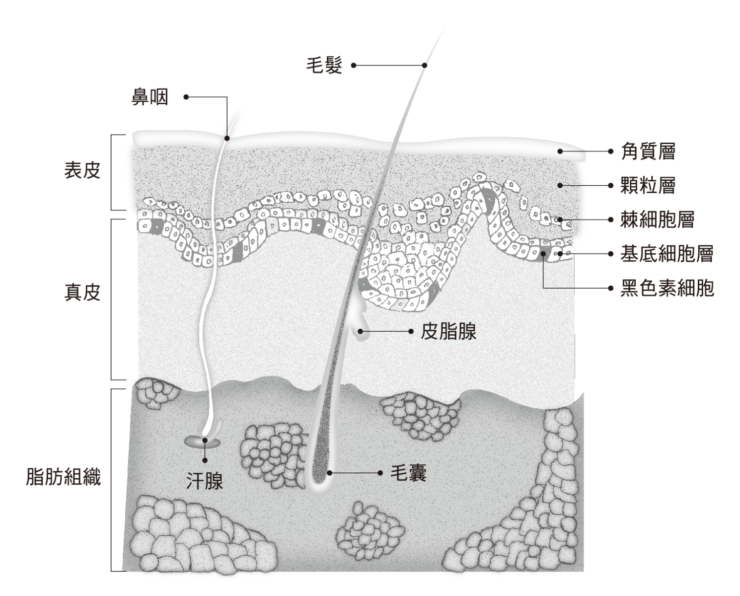 皮膚癌