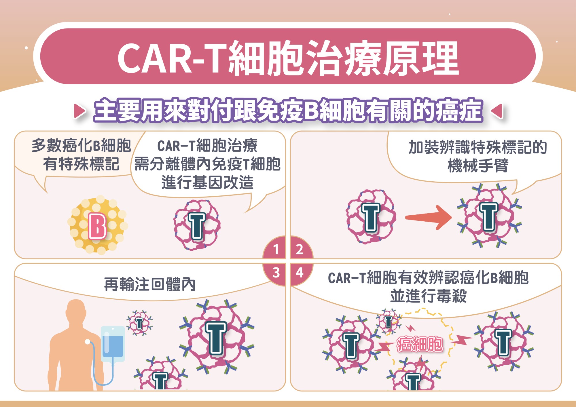 CAR-T細胞治療原理